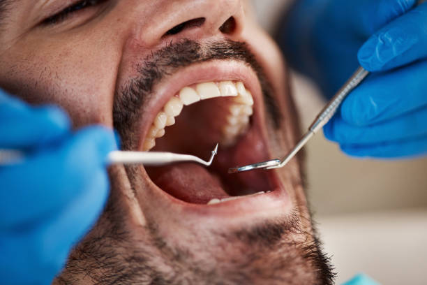 Best Emergency Treatment for Dental Infections or Abscesses in Fair Lawn, NJ